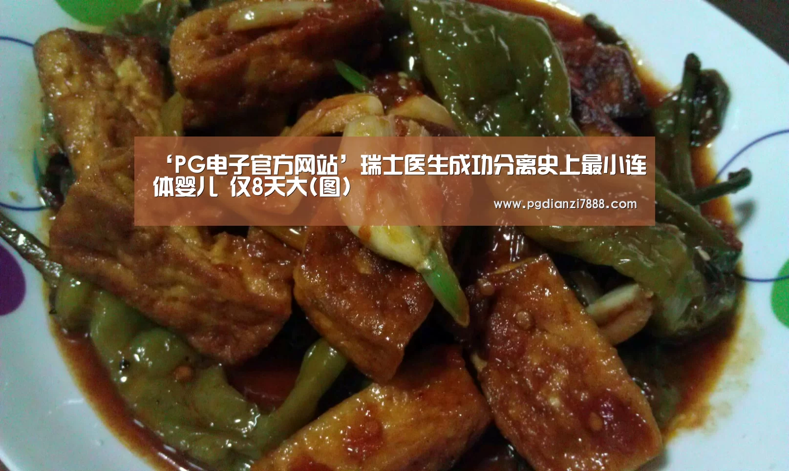 ‘PG电子官方网站’瑞士医生成功分离史上最小连体婴儿 仅8天大(图)(图1) PG电子官方网站
